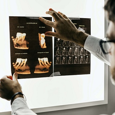 ZubiŠkola šaha Hrvatska | Zubni implanti Beograd